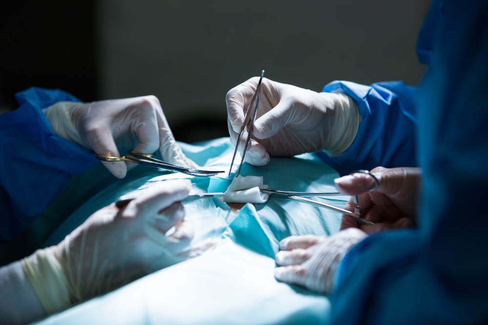 Laparoscopic Hysterectomy: Procedure, Benefits, Risks, and Recovery