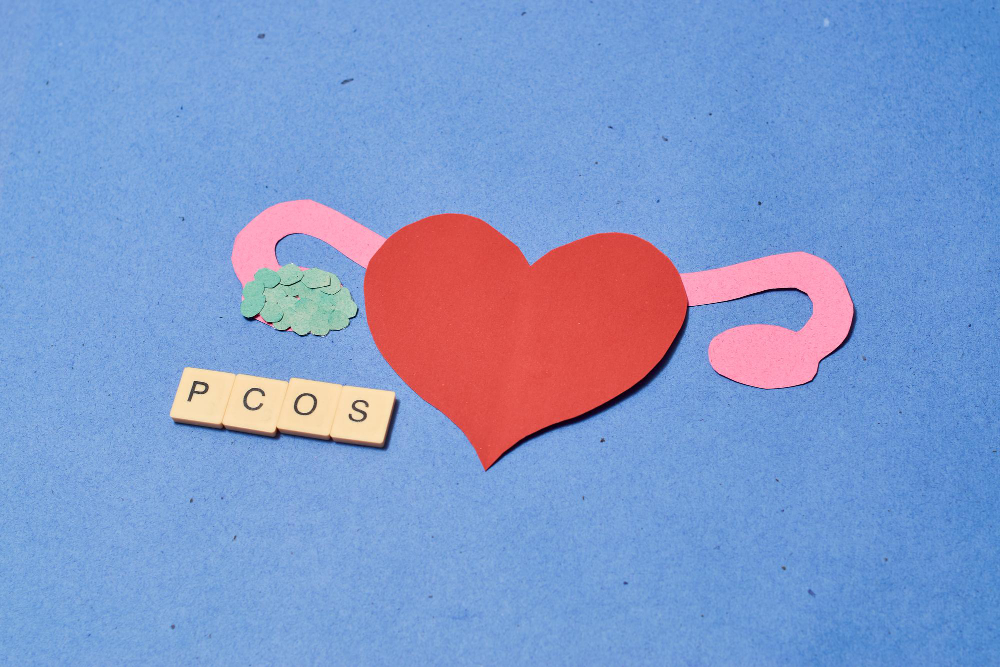 Understanding PCOS: Symptoms, Causes, Diagnosis, and Treatment